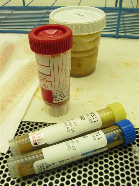 why stool test has two bottles|mixing stool test with poop.